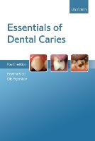 Essentials of Dental Caries (PDF eBook)